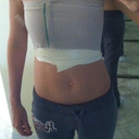 5 Hours Post-Op