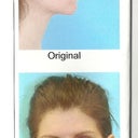 Before pictures taken in Dr. Shah's office.
