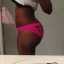 3 months post op!!!