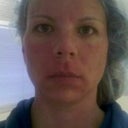 Right after the 2nd procedure