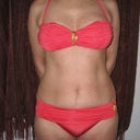 Morning before lipo 5'6", 137lbs., age 61