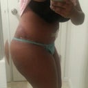 Post op day 3 right side