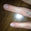It has faded even more after healing