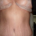 After 2.5 weeks