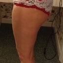 side view - before