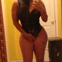 Love my hips 1.5 weeks PO