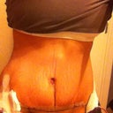 Post tt day 2 before changing my dressing for my bb, still pretty swollen