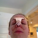 Gross shot but wanted to show the old nostrils looking ok!