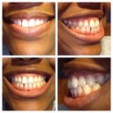 Before Pics