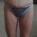 9 weeks post op.  
scars are fading!