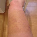 Day 7 - Front of Leg