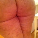 Day 7 - back