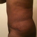 3 Weeks PO.  My side view is improving.  My scar is also fading fast.