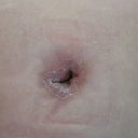 Day 16 belly button, hardly draining
