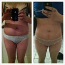 this is my before and after pic, the one on the left is 2 days before surgery, the one on the right is 3 months post op.. it looks like i have a lil bit of a waist now!