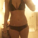 11 days post-op front