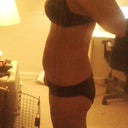 11 days post-op side