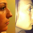 Before versus April 2012