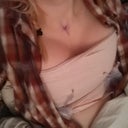 hour after surgery