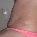 u can see here there is some extra skin