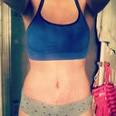 8 weeks: still swelling but feeling great
