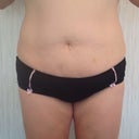 front view before