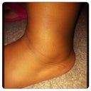 swollen ankles ;( aka cankles