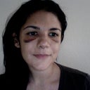 Day of splint removal (without concealer) - 1 week postop