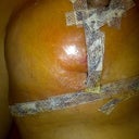 If you look closely, this was my left breast and you can see the redness along my vertical incision. EVERYTHING will look abnormal to you after surgery, but look for redness and warmth, because those are signs of infection.