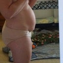 BEFORE SURGERY