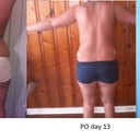 before, Po day 13, PO day 28
