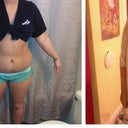 before, PO day 8