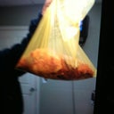 This is the picture of the 16lbs of fat they took off nasty