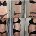 Week 3 post op vs. before