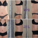 Day 6 post op vs. Week 3 post op