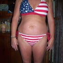 10-31-11 before surgery