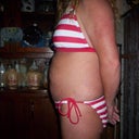 10-31-11 before surgery