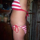 10-31-11 before surgery