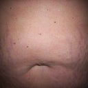 10-31-11 before surgery