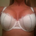 18 days post op 36 DD they are dropping slowly still up to my chin.. but they look good in a bra. But too High!!