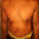 5 days (belly button seems high)