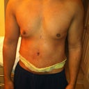 5 days (belly button seems a high)