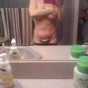 this is me at 4 wks i look flatter at 2 wks.  im swollen i guess