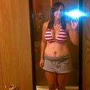 the after... 5 days post op with swelling but the results are already outstanding!