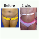 beginning of week 2. had maxi pads around waist and in bra. it burns sooo bad