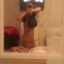 2 days post op