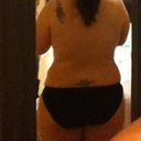 Back 10 post surgery