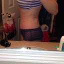12 weeks post op