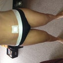 I week post op