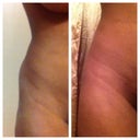 Before and 8 weeks after